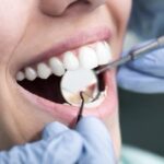 YOU SAID IT: Dental plan without dentists