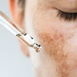 Tretinoin or Retinol: What Do Doctors Actually Recommend?